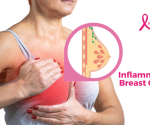 Order Breast cancers online