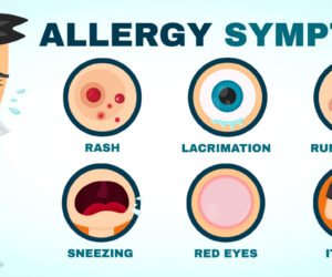 Buy Allergy online UK